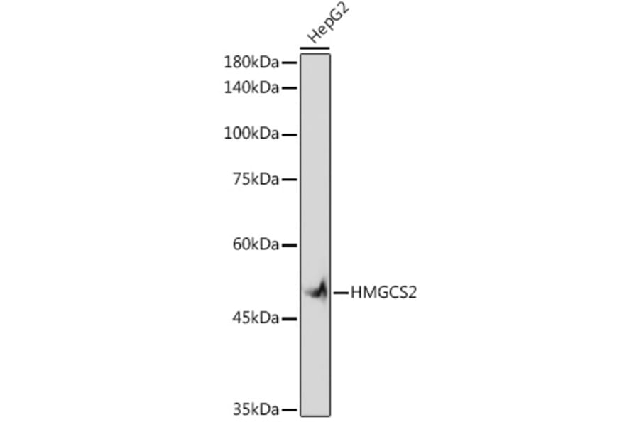 Western Blot - Anti-HMGCS2 Antibody [ARC2390] (A305318) - Antibodies.com