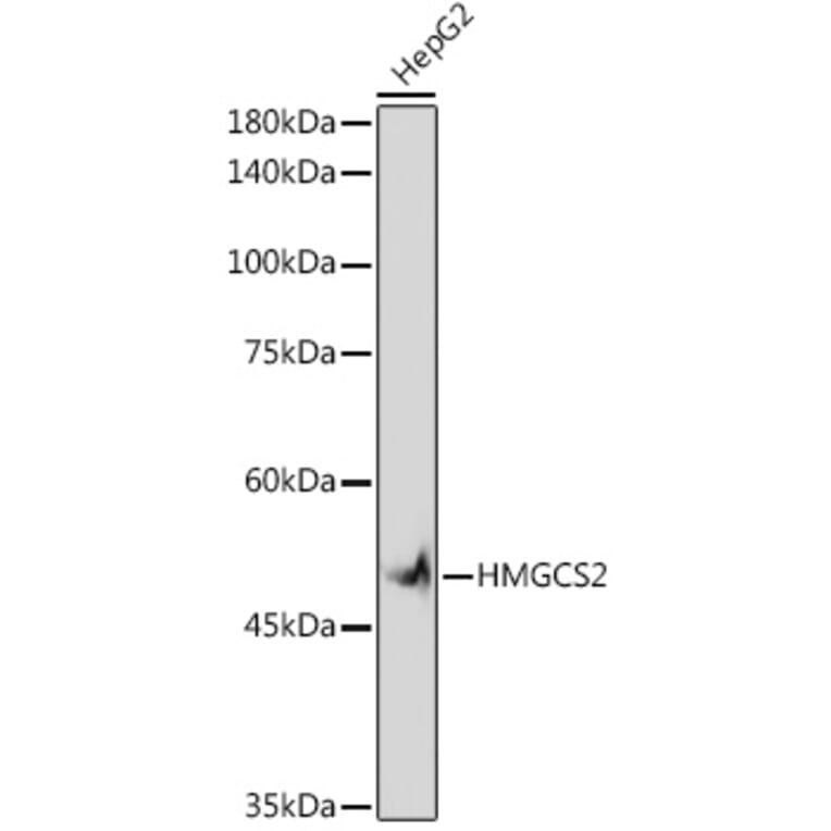 Western Blot - Anti-HMGCS2 Antibody [ARC2390] (A305318) - Antibodies.com