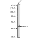 Western Blot - Anti-HMGCS2 Antibody [ARC2390] (A305318) - Antibodies.com