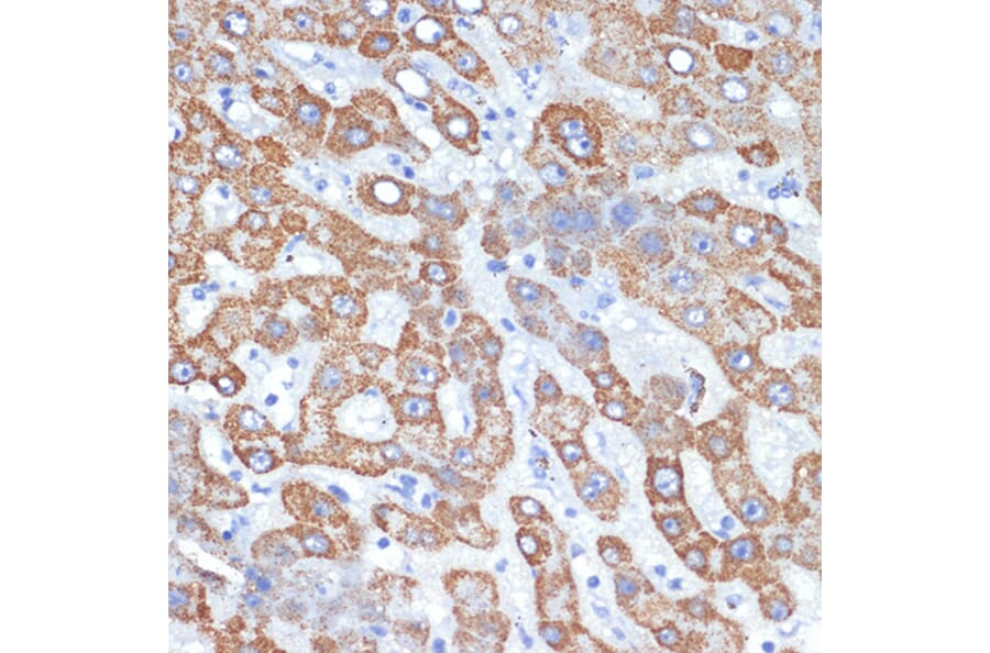 Immunohistochemistry - Anti-HMGCS2 Antibody [ARC2390] (A305318) - Antibodies.com