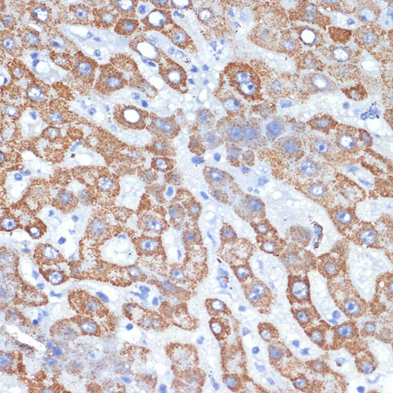 Immunohistochemistry - Anti-HMGCS2 Antibody [ARC2390] (A305318) - Antibodies.com