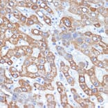 Immunohistochemistry - Anti-HMGCS2 Antibody [ARC2390] (A305318) - Antibodies.com