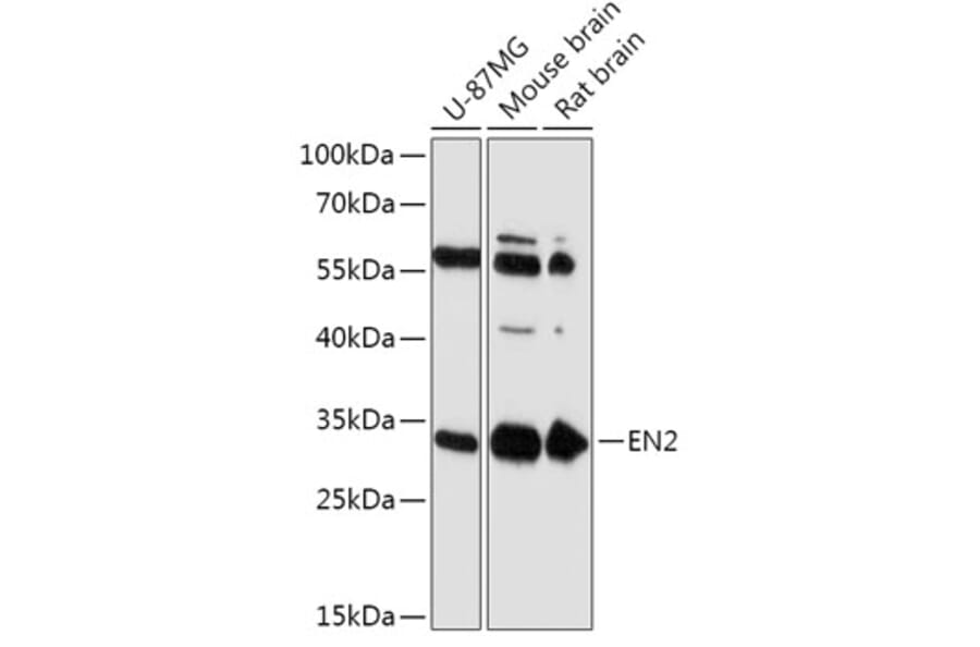 Western Blot - Anti-EN2 Antibody (A305319) - Antibodies.com