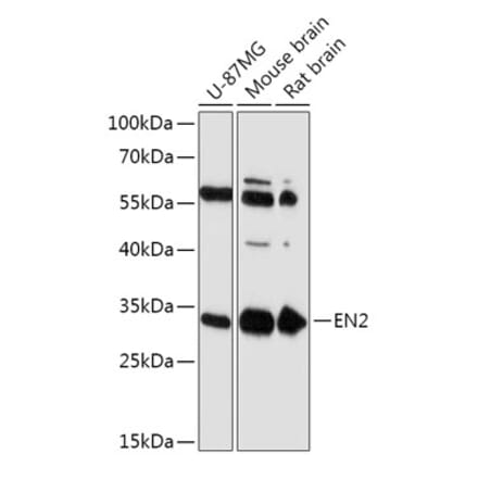 Western Blot - Anti-EN2 Antibody (A305319) - Antibodies.com