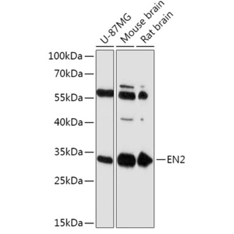 Western Blot - Anti-EN2 Antibody (A305319) - Antibodies.com
