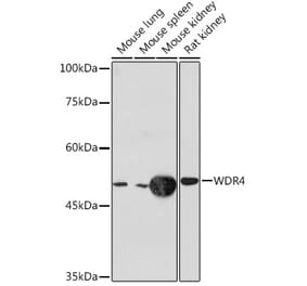 Western Blot - Anti-WDR4 Antibody [ARC2292] (A305320) - Antibodies.com
