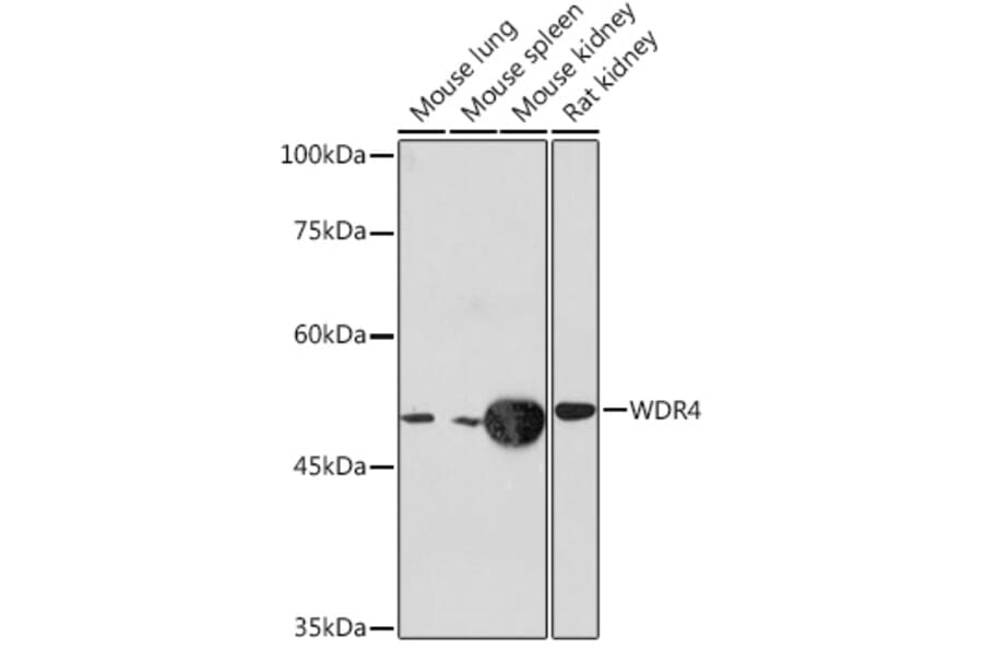 Western Blot - Anti-WDR4 Antibody [ARC2292] (A305320) - Antibodies.com