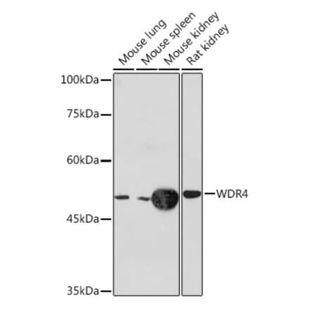 Western Blot - Anti-WDR4 Antibody [ARC2292] (A305320) - Antibodies.com