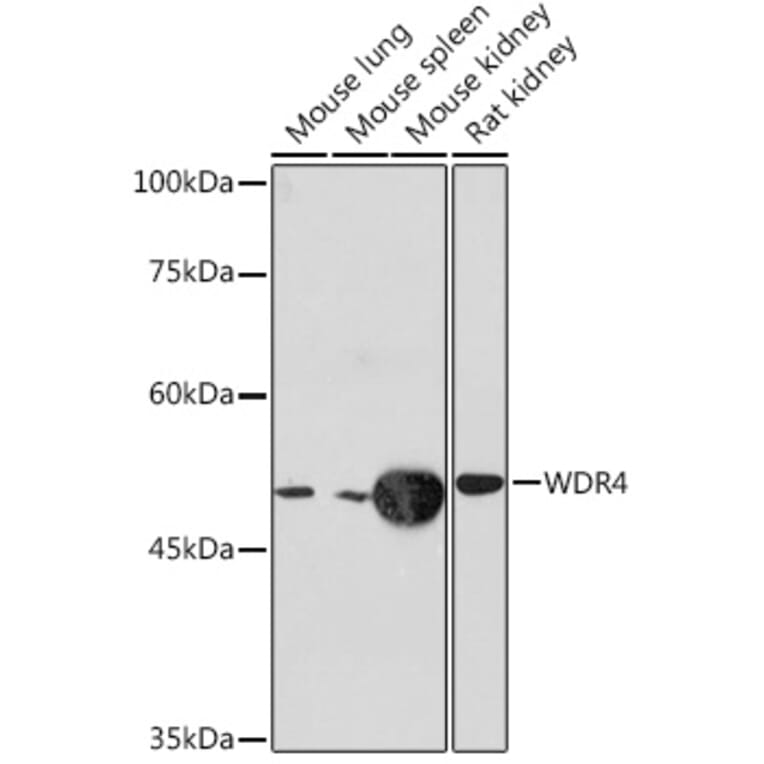 Western Blot - Anti-WDR4 Antibody [ARC2292] (A305320) - Antibodies.com