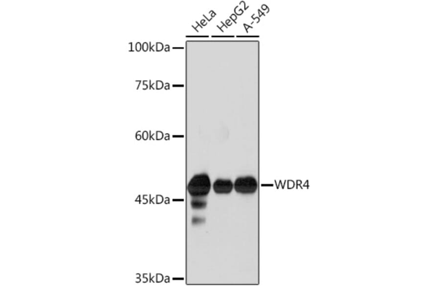Western Blot - Anti-WDR4 Antibody [ARC2292] (A305320) - Antibodies.com