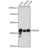 Western Blot - Anti-WDR4 Antibody [ARC2292] (A305320) - Antibodies.com
