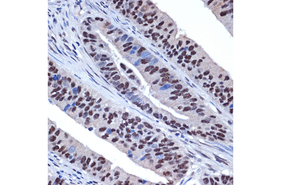 Immunohistochemistry - Anti-WDR4 Antibody [ARC2292] (A305320) - Antibodies.com