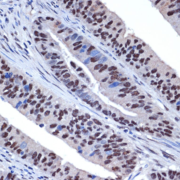 Immunohistochemistry - Anti-WDR4 Antibody [ARC2292] (A305320) - Antibodies.com