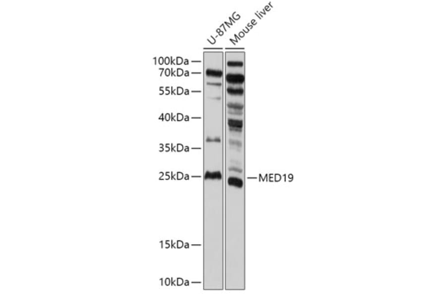 Western Blot - Anti-MED19 Antibody (A305321) - Antibodies.com