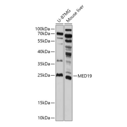 Western Blot - Anti-MED19 Antibody (A305321) - Antibodies.com