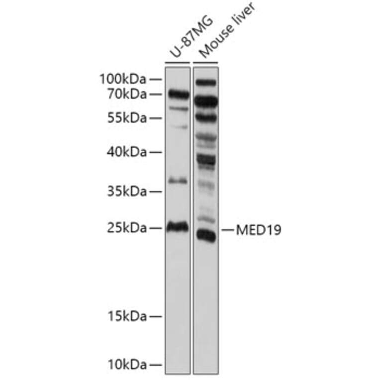 Western Blot - Anti-MED19 Antibody (A305321) - Antibodies.com