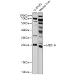 Western Blot - Anti-MED19 Antibody (A305321) - Antibodies.com