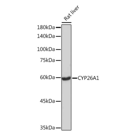 Western Blot - Anti-CYP26A1 Antibody [ARC2126] (A305322) - Antibodies.com