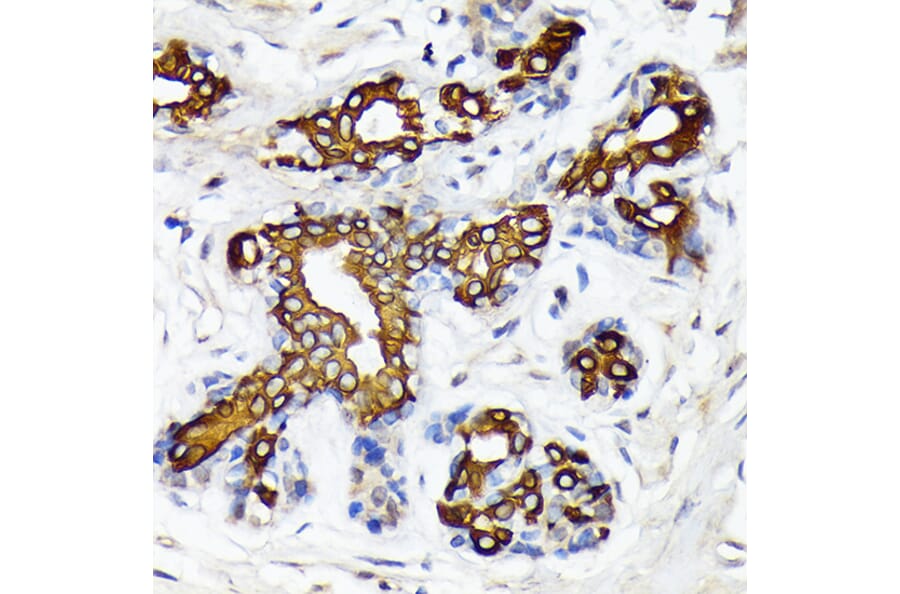 Immunohistochemistry - Anti-CYP26A1 Antibody [ARC2126] (A305322) - Antibodies.com