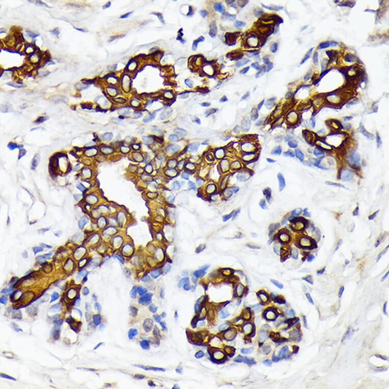 Immunohistochemistry - Anti-CYP26A1 Antibody [ARC2126] (A305322) - Antibodies.com