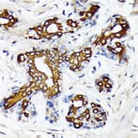 Immunohistochemistry - Anti-CYP26A1 Antibody [ARC2126] (A305322) - Antibodies.com
