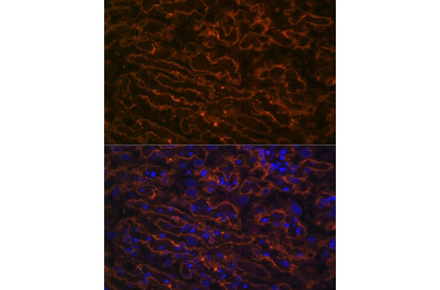 Immunofluorescence - Anti-CYP26A1 Antibody [ARC2126] (A305322) - Antibodies.com