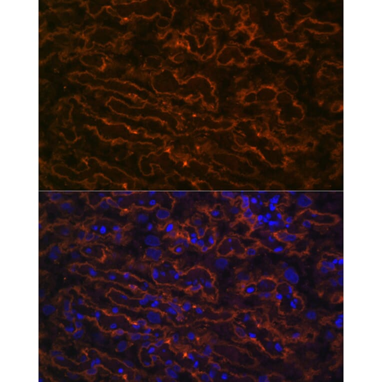 Immunofluorescence - Anti-CYP26A1 Antibody [ARC2126] (A305322) - Antibodies.com