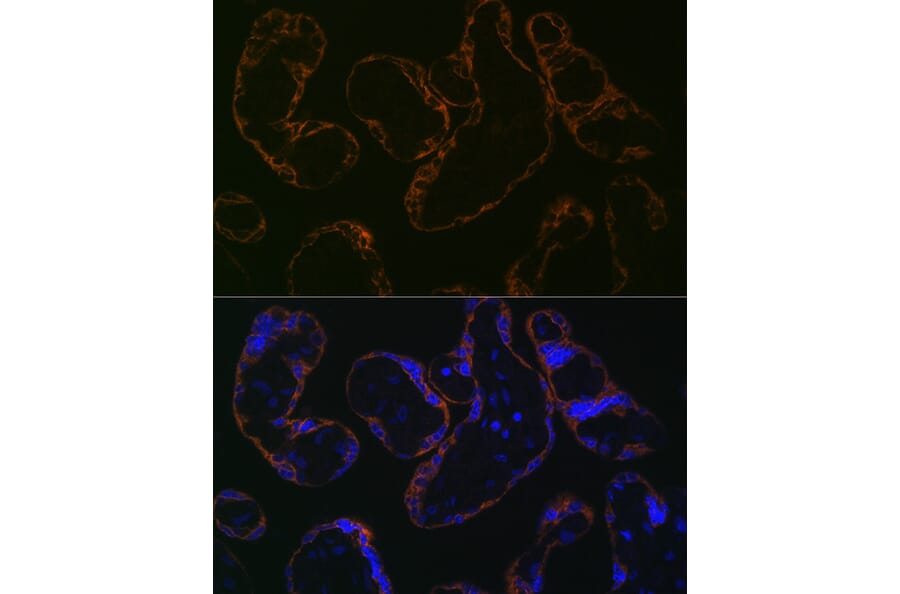 Immunofluorescence - Anti-CYP26A1 Antibody [ARC2126] (A305322) - Antibodies.com