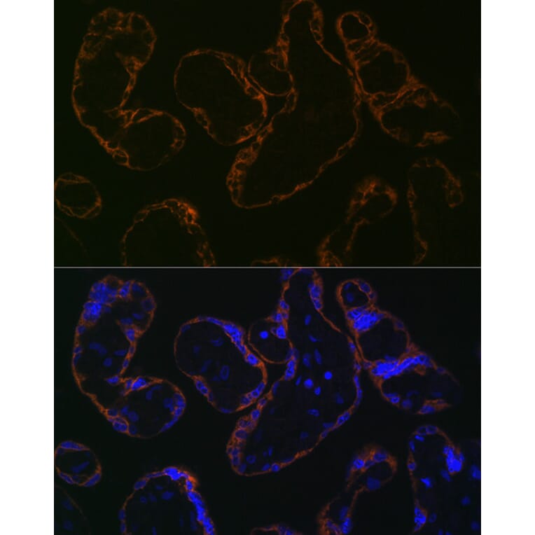 Immunofluorescence - Anti-CYP26A1 Antibody [ARC2126] (A305322) - Antibodies.com