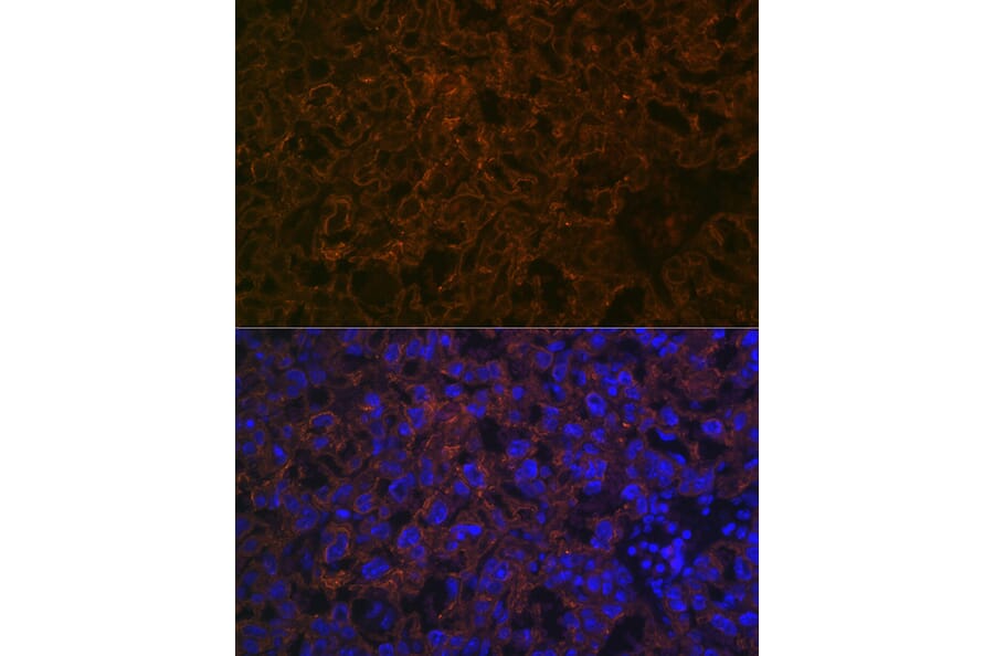 Immunofluorescence - Anti-CYP26A1 Antibody [ARC2126] (A305322) - Antibodies.com