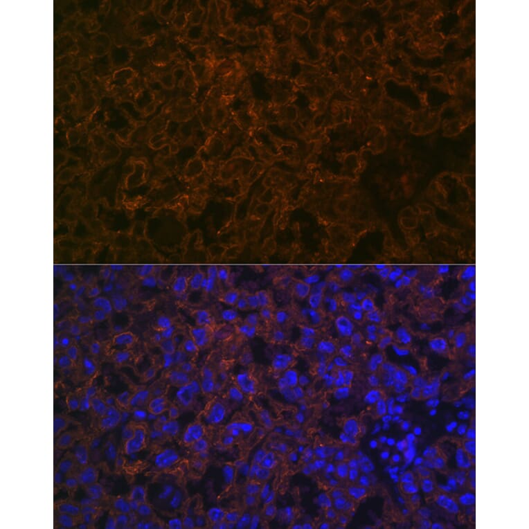 Immunofluorescence - Anti-CYP26A1 Antibody [ARC2126] (A305322) - Antibodies.com
