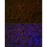 Immunofluorescence - Anti-CYP26A1 Antibody [ARC2126] (A305322) - Antibodies.com