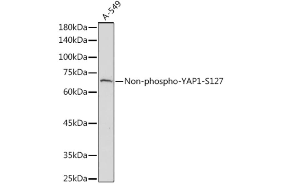 Western Blot - Anti-YAP1 Antibody (A305323) - Antibodies.com