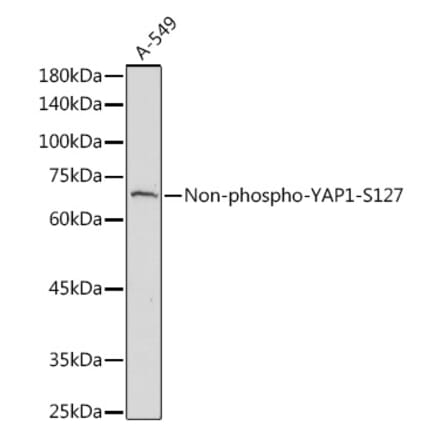 Western Blot - Anti-YAP1 Antibody (A305323) - Antibodies.com