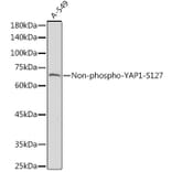 Western Blot - Anti-YAP1 Antibody (A305323) - Antibodies.com
