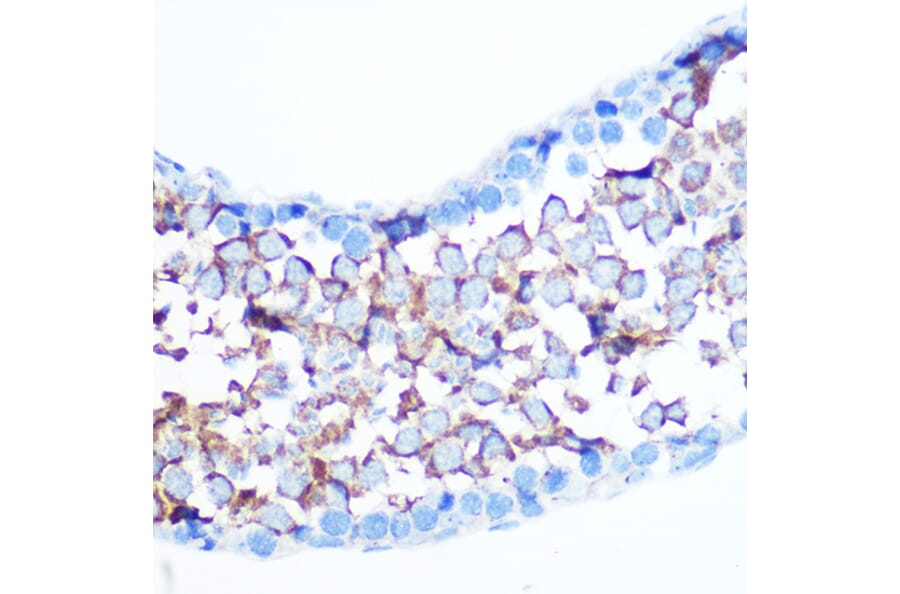 Immunohistochemistry - Anti-YAP1 Antibody (A305323) - Antibodies.com