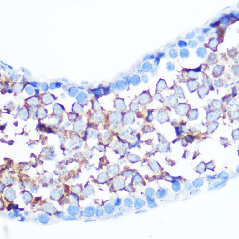 Immunohistochemistry - Anti-YAP1 Antibody (A305323) - Antibodies.com