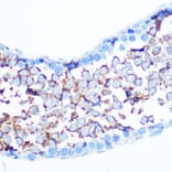 Immunohistochemistry - Anti-YAP1 Antibody (A305323) - Antibodies.com