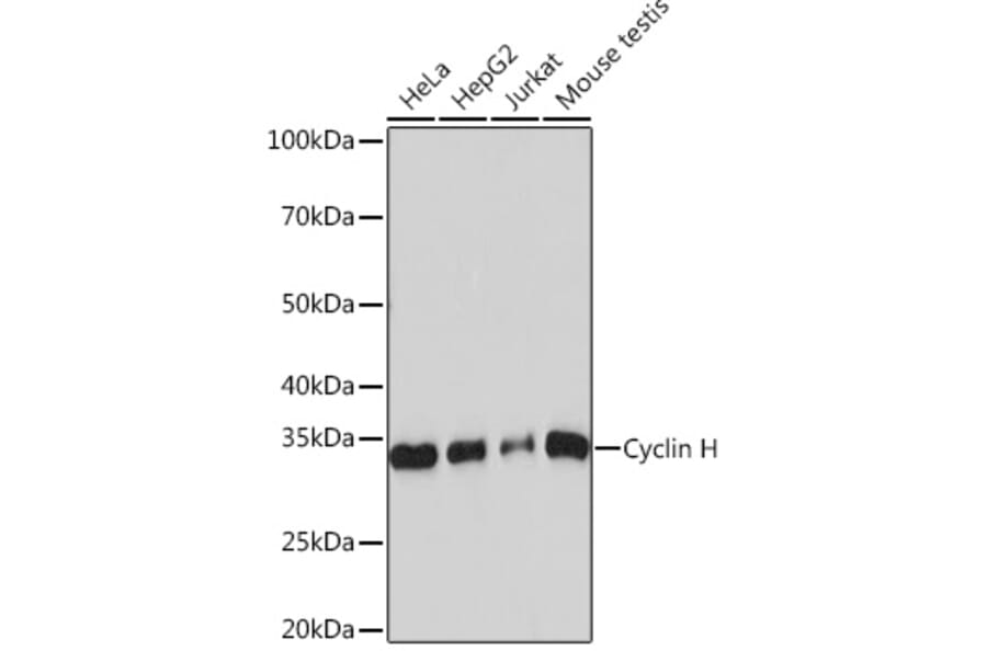 Western Blot - Anti-Cyclin H/p34 Antibody [ARC0893] (A305324) - Antibodies.com