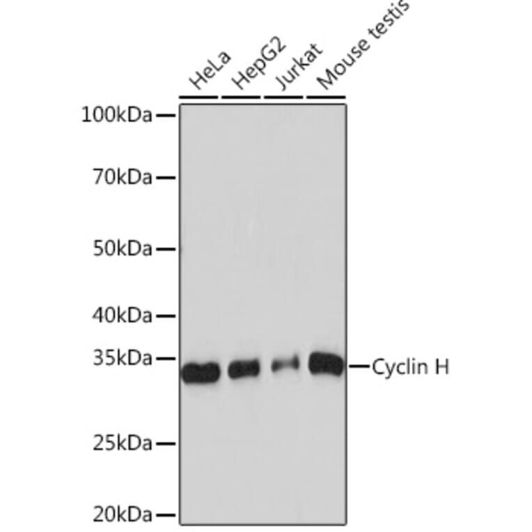 Western Blot - Anti-Cyclin H/p34 Antibody [ARC0893] (A305324) - Antibodies.com