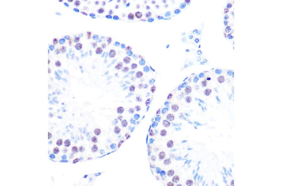 Immunohistochemistry - Anti-Cyclin H/p34 Antibody [ARC0893] (A305324) - Antibodies.com