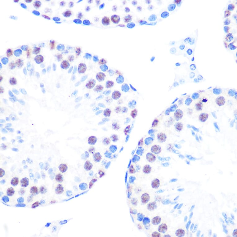 Immunohistochemistry - Anti-Cyclin H/p34 Antibody [ARC0893] (A305324) - Antibodies.com