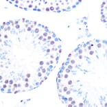 Immunohistochemistry - Anti-Cyclin H/p34 Antibody [ARC0893] (A305324) - Antibodies.com