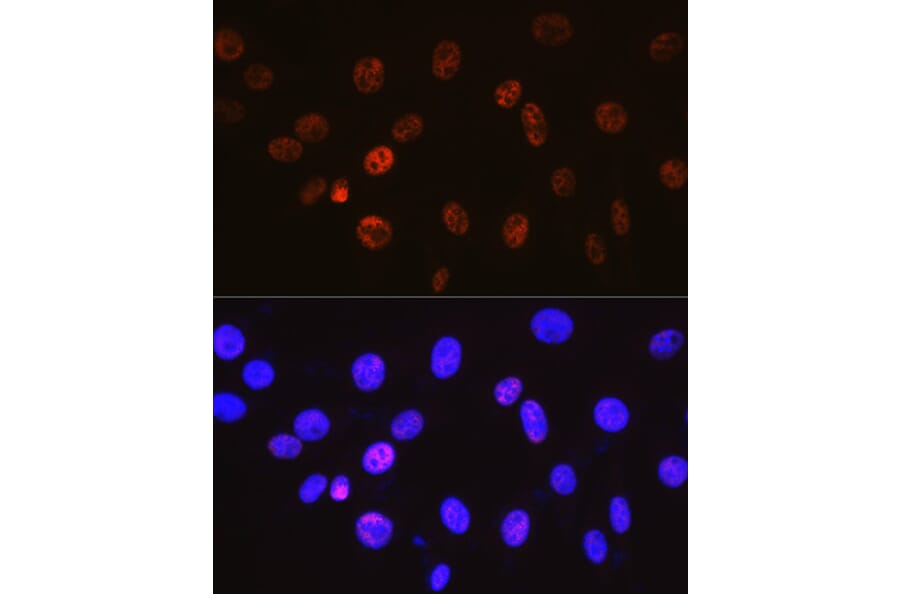 Immunofluorescence - Anti-Cyclin H/p34 Antibody [ARC0893] (A305324) - Antibodies.com