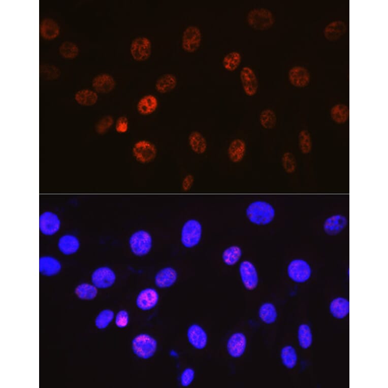 Immunofluorescence - Anti-Cyclin H/p34 Antibody [ARC0893] (A305324) - Antibodies.com