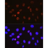 Immunofluorescence - Anti-Cyclin H/p34 Antibody [ARC0893] (A305324) - Antibodies.com