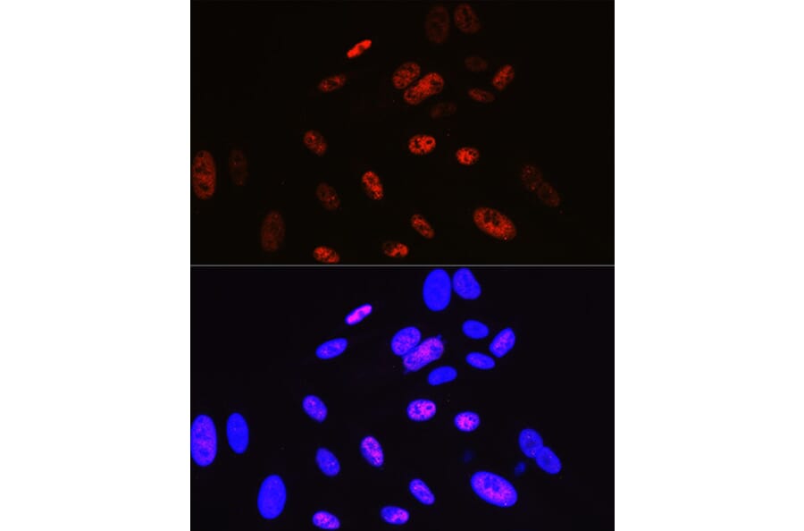 Immunofluorescence - Anti-Cyclin H/p34 Antibody [ARC0893] (A305324) - Antibodies.com