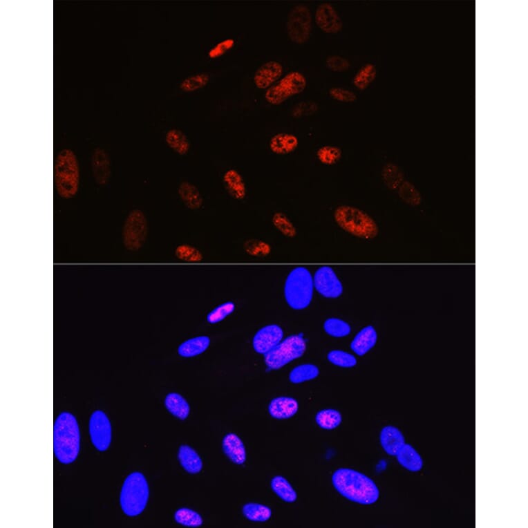 Immunofluorescence - Anti-Cyclin H/p34 Antibody [ARC0893] (A305324) - Antibodies.com