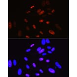Immunofluorescence - Anti-Cyclin H/p34 Antibody [ARC0893] (A305324) - Antibodies.com