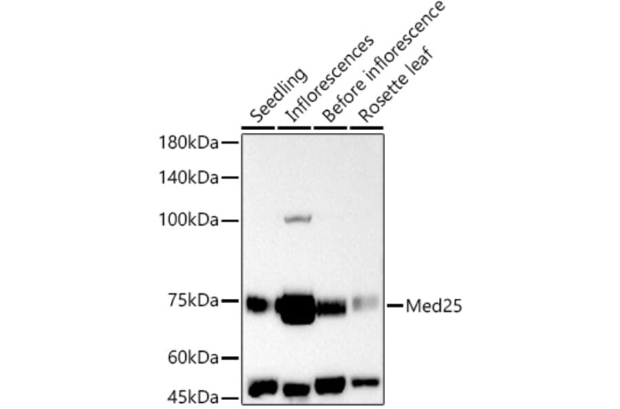 Western Blot - Anti-MED25 Antibody (A305325) - Antibodies.com